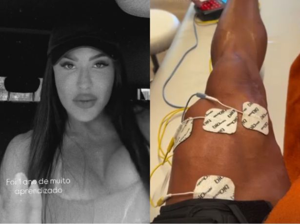 Gracyanne Barbosa celebra melhora no joelho após um ano de cirurgia