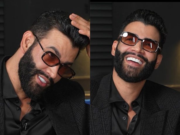 Gusttavo Lima admite luta contra fios brancos e revela se pinta o cabelo