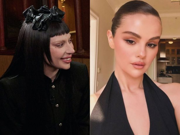 Lúpus, doença de famosas como Selena Gomez e Lady Gaga, pode causar problemas na visão