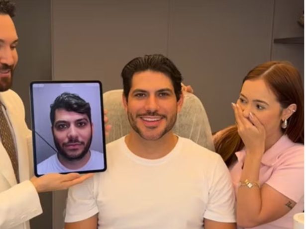 Mirela Janis mostra o antes e o depois da harmonização facial de Yugnir