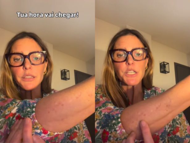 Fernanda Lima ironiza sobre manchas na pele: “Achei que ia envelhecer numa boa”