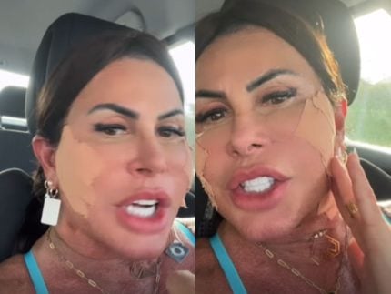 Gretchen atualiza sobre nova cirurgia plástica e rebate haters: “Bem amada”