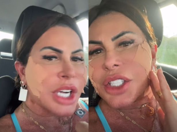 Gretchen atualiza sobre nova cirurgia plástica e rebate haters: “Bem amada”