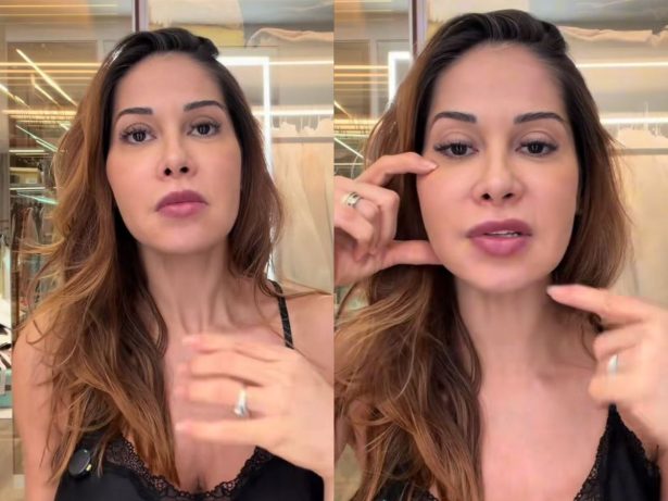 Maíra Cardi busca cirurgia para remover procedimento do rosto: “Abrir a cara inteira”
