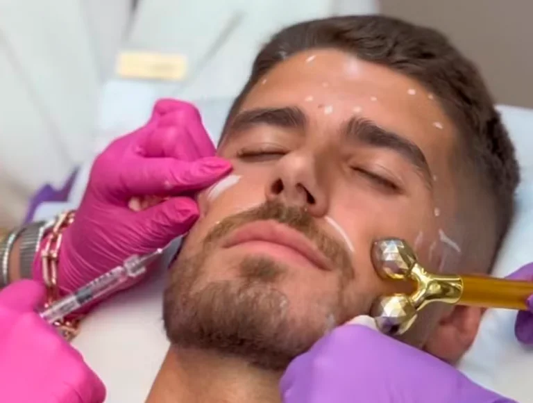 Pedro Raul, do Corinthians, renova harmonização facial. Veja resultado