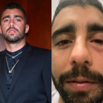 Especialista faz alerta após caso de Pedro Scooby vir à tona: “Nunca ignore”