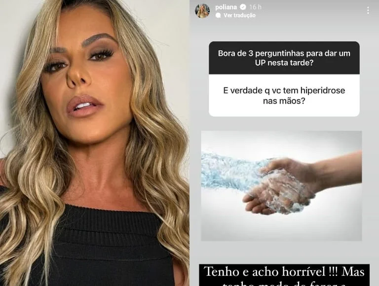 Poliana Rocha revela ter hiperidrose nas mãos e medo de tratamento cirúrgico