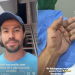 Mariano, dupla de Munhoz, sofre acidente doméstico e precisa levar pontos na mão