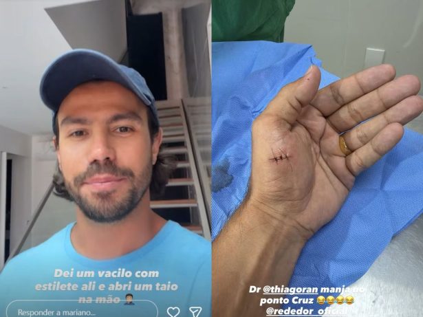 Mariano, dupla de Munhoz, sofre acidente doméstico e precisa levar pontos na mão