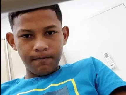 Especialista explica o que aconteceu com adolescente que morreu após bolada