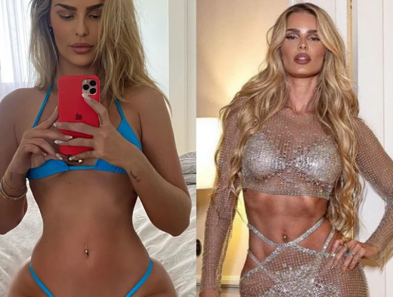 Retoques finais! Yasmin fez nova lipo antes do BBB24. Veja antes e depois!