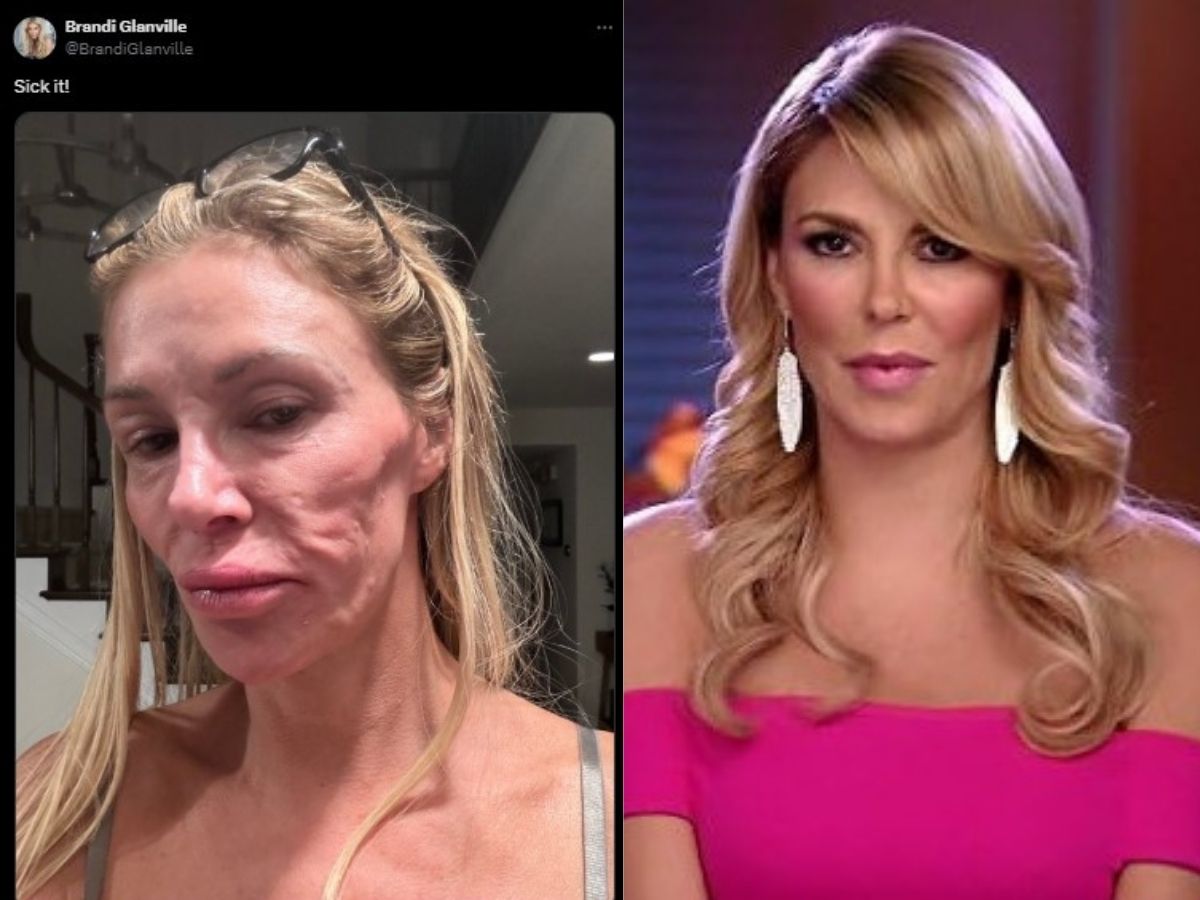 Reprodução: X Brandi Glanville/Bravo/Montagem