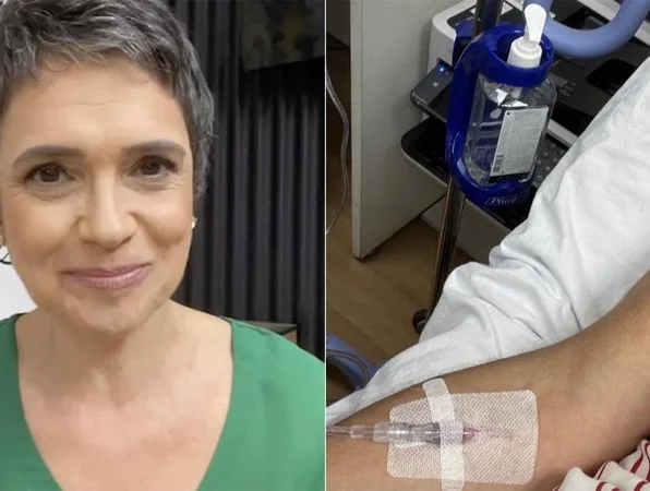 Sandra Annenberg conta como que foi picada por taturana venenosa: “Dor alucinante”