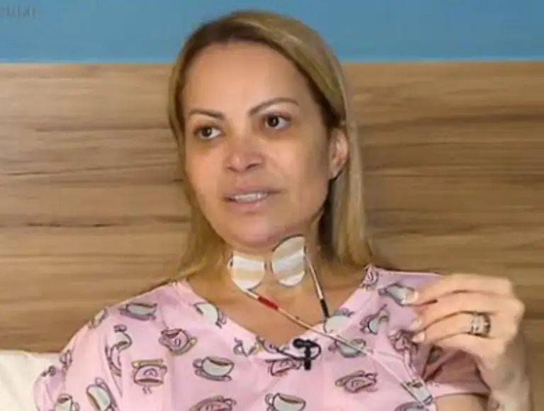 Solange Almeida detalha consequência na voz por uso de cigarro eletrônico
