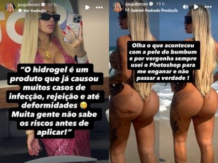 Juju Ferrari detalha procedimento estético que fez nos glúteos