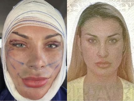 Sufoco! Após cirurgias, biometria facial de Andressa Urach falha na imigração