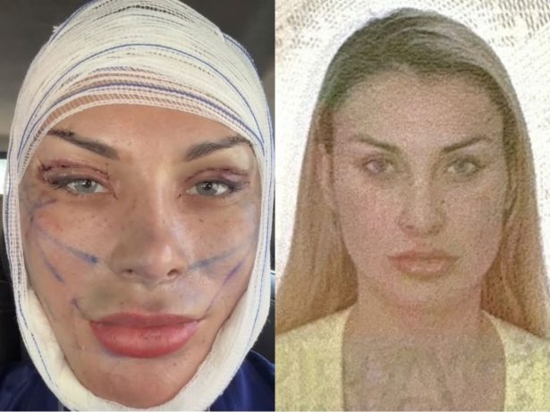 Sufoco! Após cirurgias, biometria facial de Andressa Urach falha na imigração