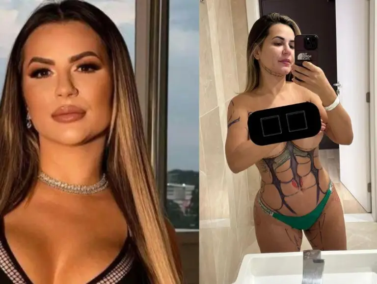 Saiba o valor e  veja o antes e depois da lipo LAD de Deolane Bezerra!