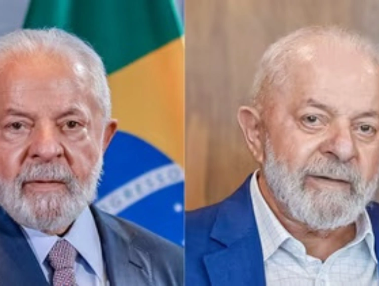 Plástica nos olhos: veja o antes e depois de Lula após procedimento