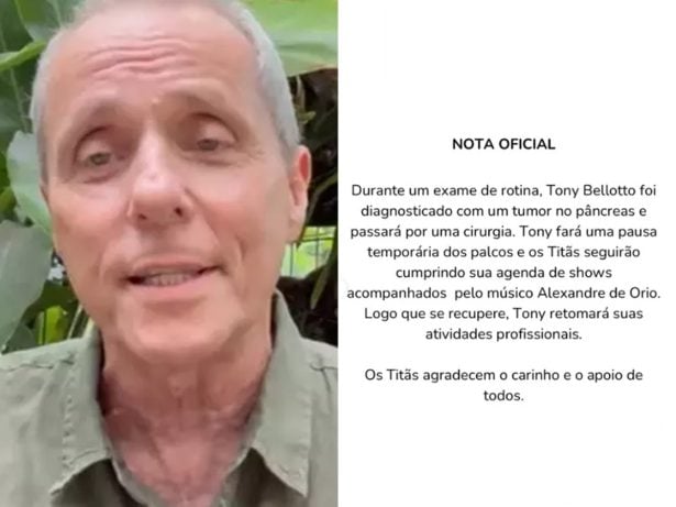 Tony Bellotto, do Titãs, é diagnosticado com tumor no pâncreas