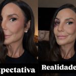 Expectativa x realidade: Ivete Sangalo mostra como ficou o rosto após cair e se machucar