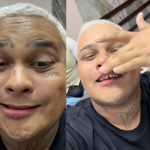 Mc Ryan surpreende ao aparecer sem facetas e mostrar a realidade dos dentes