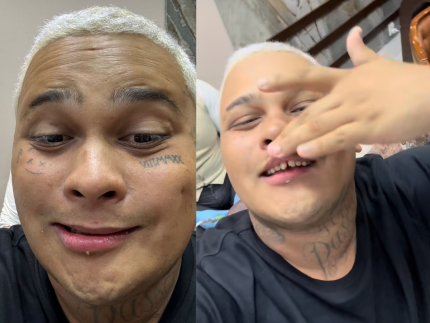 Mc Ryan surpreende ao aparecer sem facetas e mostrar a realidade dos dentes