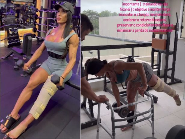 Gracyanne desabafa sobre ficar com uma perna mais fina: “Agora o foco é me recuperar”