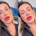 Urach desabafa que ainda está com dor após mudar cor dos olhos: “Medo de ficar cega”