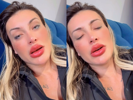 Urach desabafa que ainda está com dor após mudar cor dos olhos: “Medo de ficar cega”