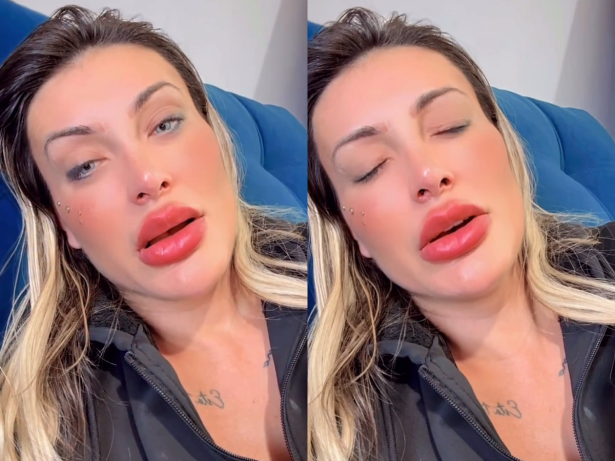Urach desabafa que ainda está com dor após mudar cor dos olhos: “Medo de ficar cega”